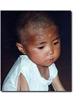 North Korean child